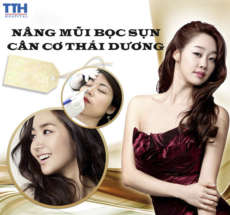 Nâng mũi bọc cân cơ thái dương